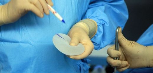 Plastický chirurg si právě připravuje silikonový implantát (ilustrační foto).